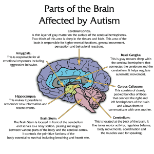 Brain_Autism