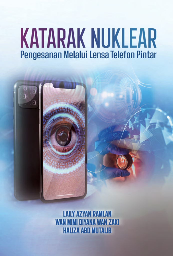 Katarak Nuklear: Pengesanan Melalui Lensa Telefon Pintar
