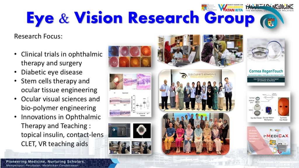 Vision Reseaerch Eye & Vision Research - Secretariat of Research & Innovation Faculty of ...